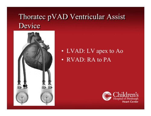 Pediatric Ventricular Assist Devices - University of Minnesota ...