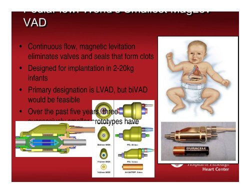 Pediatric Ventricular Assist Devices - University of Minnesota ...