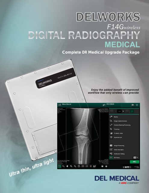 DelWorks F14G Wireless DR: Brochure - Del Medical
