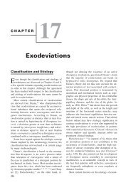 Chapter 17: Exodeviations