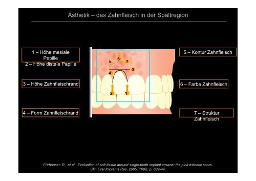 Aktuelle Forschungsprojekte Spaltzentrum - LKG-Zentrums ...