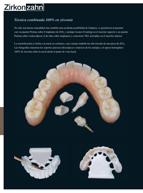 ALL ZIRCONIA - Zirkonzahn