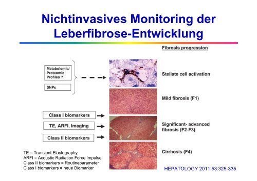 Allgemeine Labordiagnostik von Lebererkrankungen - Institut für ...