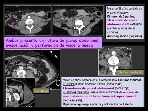 lesiones abdominales