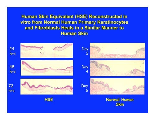 Wound Healing & Limb Salvage - New Jersey Center for Biomaterials