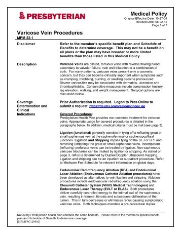 Varicose Vein Procedures - Presbyterian Healthcare Services