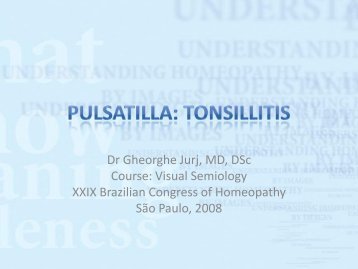 Pulsatilla: tonsillitis - Dr. Gheorghe Jurj - Homeopatie