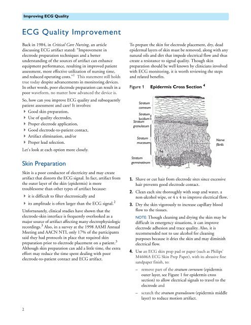 Improving ECG Quality - InCenter - Philips