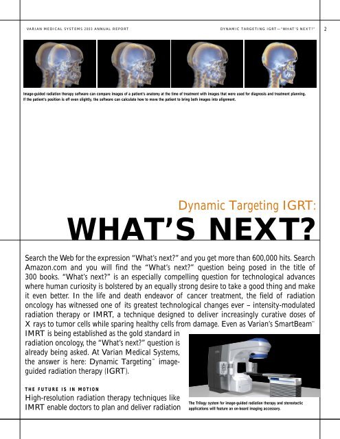 Stereotactic Radiation Therapy: Expanding Capabilities - Varian