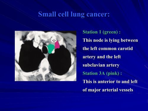 TNM STAGING OF LUNG CANCER - The Lung Center