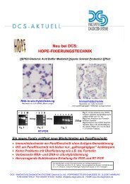 HOPE-FIXIERUNGSTECHNIK - DCS - Innovative Diagnostik-Systeme