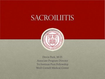 SACROILIITIS