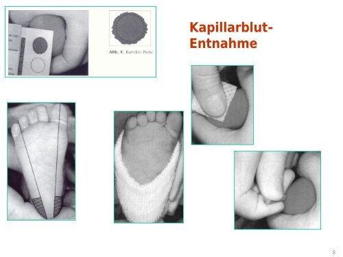 Therapie von angeborenen Stoffwechselerkrankungen