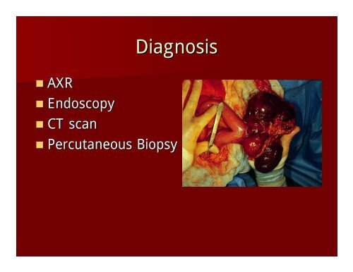 Case Presentation - Department of Surgery at SUNY Downstate ...