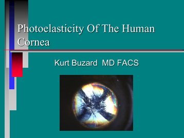 Photoelasticity Of The Human Cornea - Buzard.info