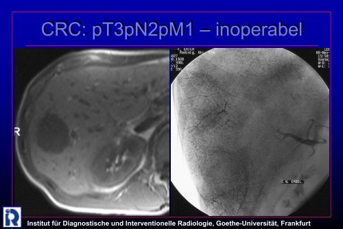 Institut fÃ¼r Diagnostische und Interventionelle Radiologie, Goethe ...