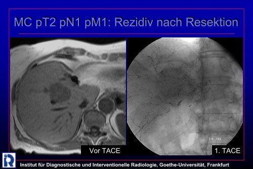 Institut fÃ¼r Diagnostische und Interventionelle Radiologie, Goethe ...