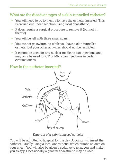 Central Venous Access Devices - The Royal Marsden