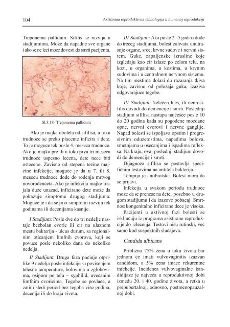 asistirana reproduktivna tehnologija u humanoj reprodukciji