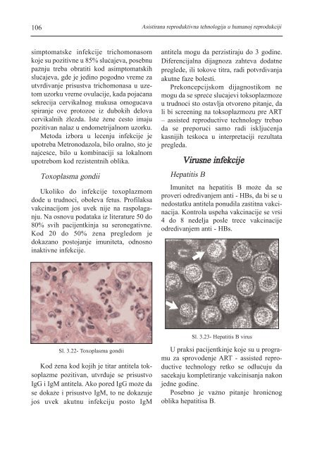 asistirana reproduktivna tehnologija u humanoj reprodukciji