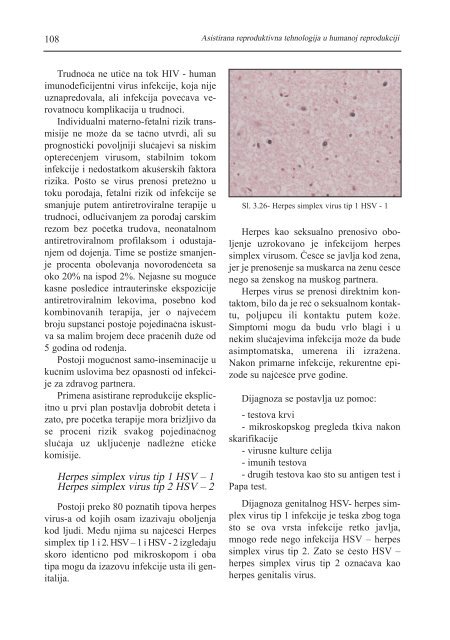 asistirana reproduktivna tehnologija u humanoj reprodukciji