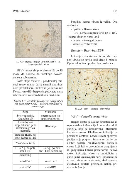 asistirana reproduktivna tehnologija u humanoj reprodukciji