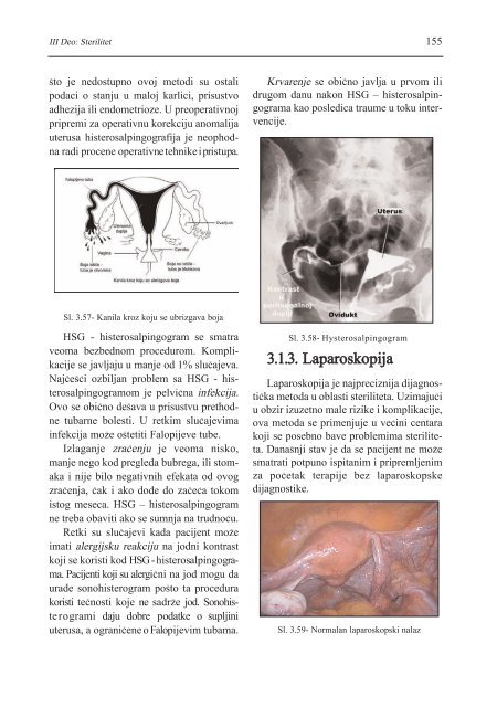 asistirana reproduktivna tehnologija u humanoj reprodukciji