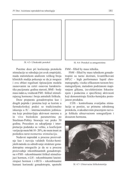 asistirana reproduktivna tehnologija u humanoj reprodukciji