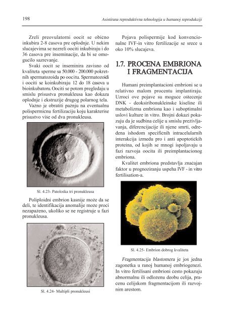 asistirana reproduktivna tehnologija u humanoj reprodukciji