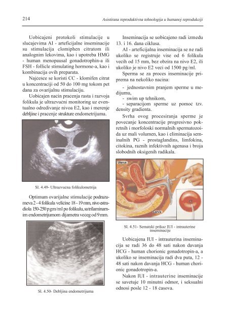 asistirana reproduktivna tehnologija u humanoj reprodukciji