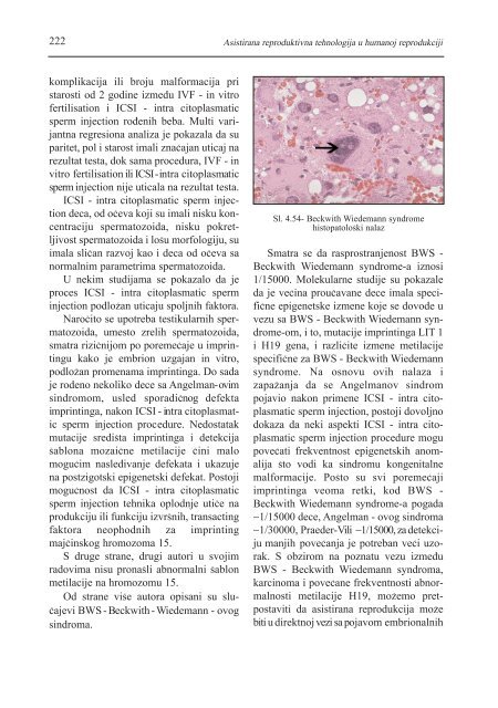 asistirana reproduktivna tehnologija u humanoj reprodukciji