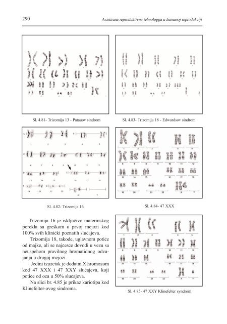 asistirana reproduktivna tehnologija u humanoj reprodukciji