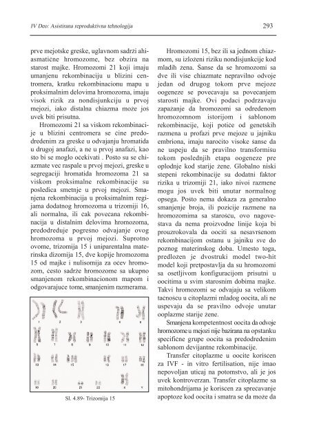 asistirana reproduktivna tehnologija u humanoj reprodukciji