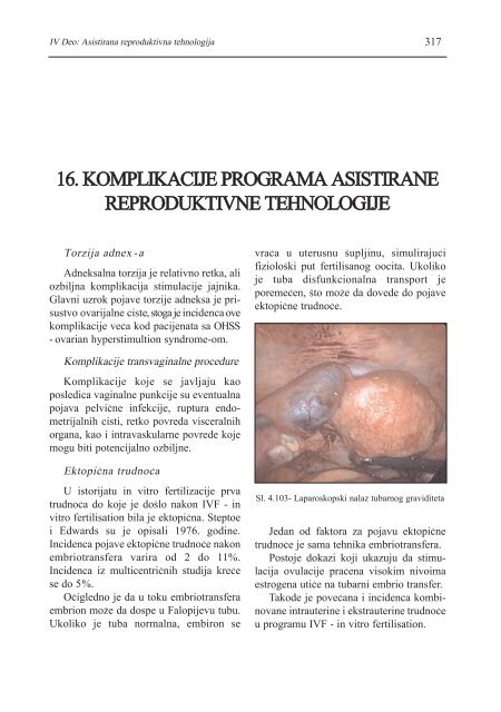 asistirana reproduktivna tehnologija u humanoj reprodukciji