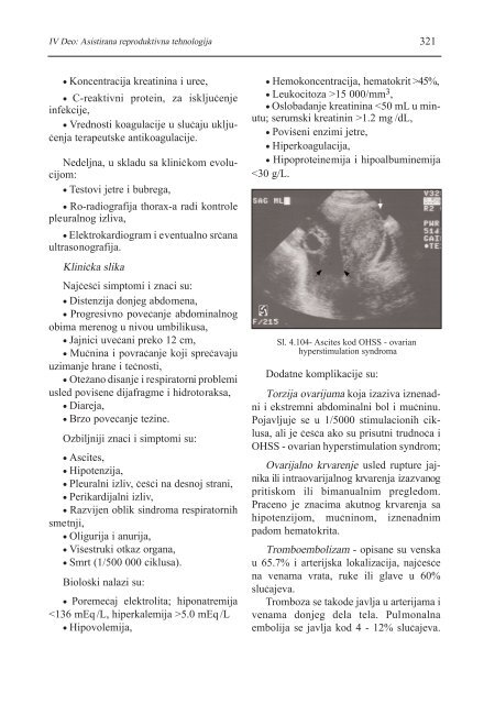 asistirana reproduktivna tehnologija u humanoj reprodukciji