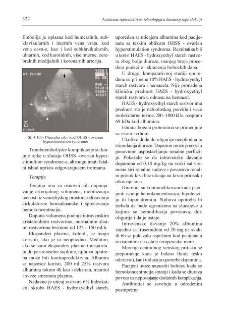 asistirana reproduktivna tehnologija u humanoj reprodukciji