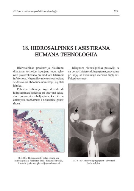 asistirana reproduktivna tehnologija u humanoj reprodukciji