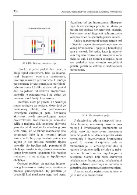 asistirana reproduktivna tehnologija u humanoj reprodukciji