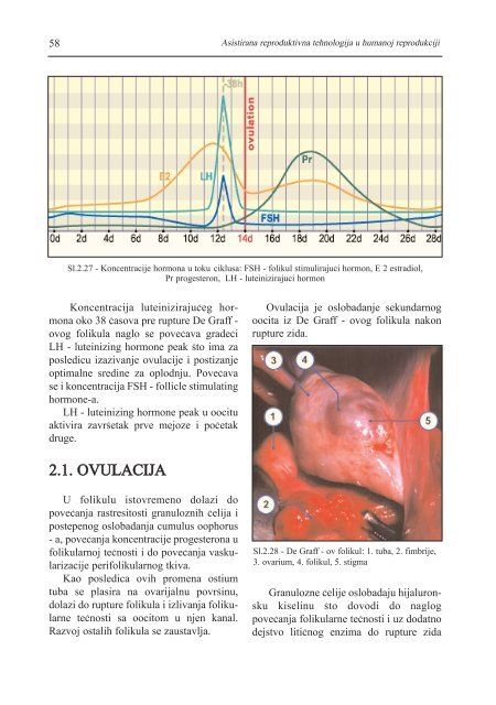 asistirana reproduktivna tehnologija u humanoj reprodukciji