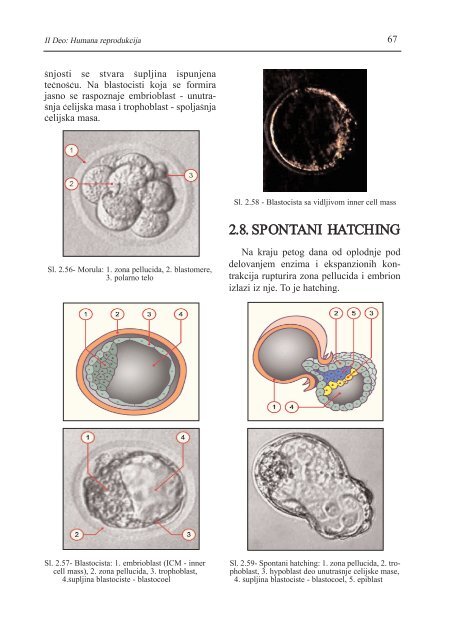 asistirana reproduktivna tehnologija u humanoj reprodukciji