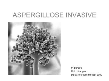 Aspergillose invasive : épidémiologie, diagnostic et traitement.