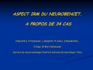 ASPECT IRM DU NEUROBEHCET. A PROPOS DE 34 CAS
