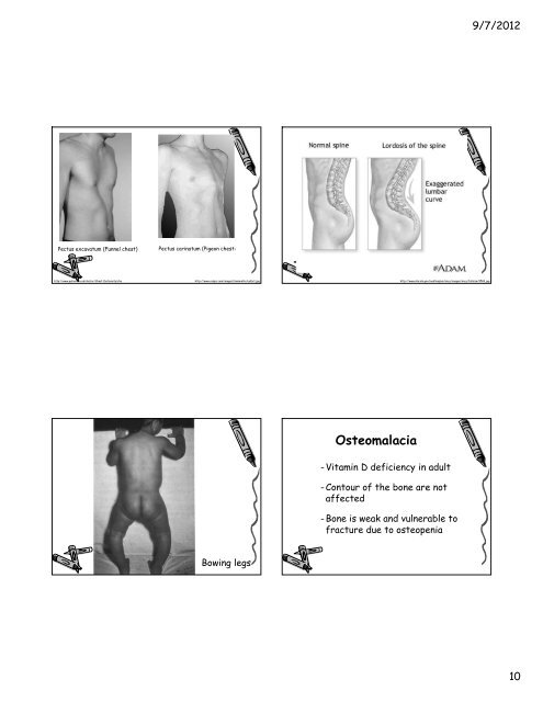 Nutritional Pathology Topics Nutritional ... - มหาวิทยาลัยนเรศวร