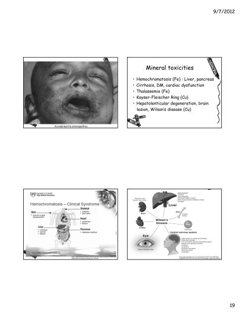 Nutritional Pathology Topics Nutritional ... - มหาวิทยาลัยนเรศวร