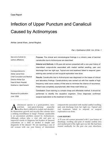 Infection of Upper Punctum and Canaliculi Caused by Actinomyces