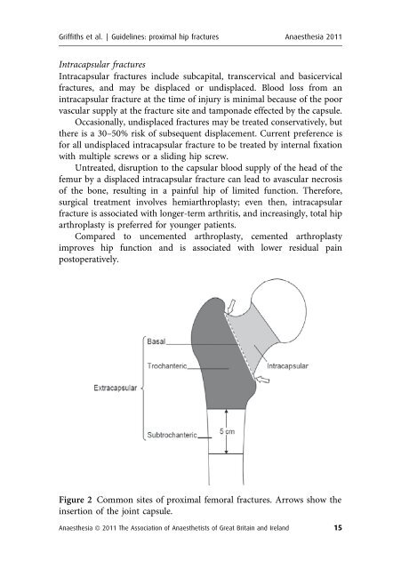 Management of Proximal Femoral Fractures 2011 - aagbi