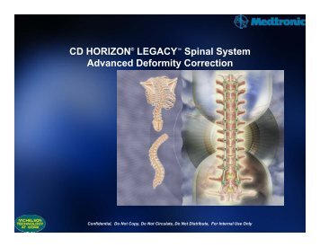 CD HORIZON® LEGACY™ Spinal System Advanced ... - Arcos