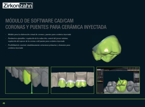 + Fresado simultÃ¡neo de 5+1 ejes - Zirkonzahn