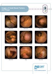 Images of Celiac Disease - Diagmed