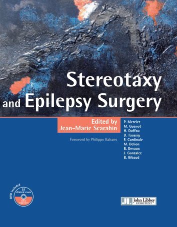 Stereotaxy and Epilepsy Surgery - 3D Slicer